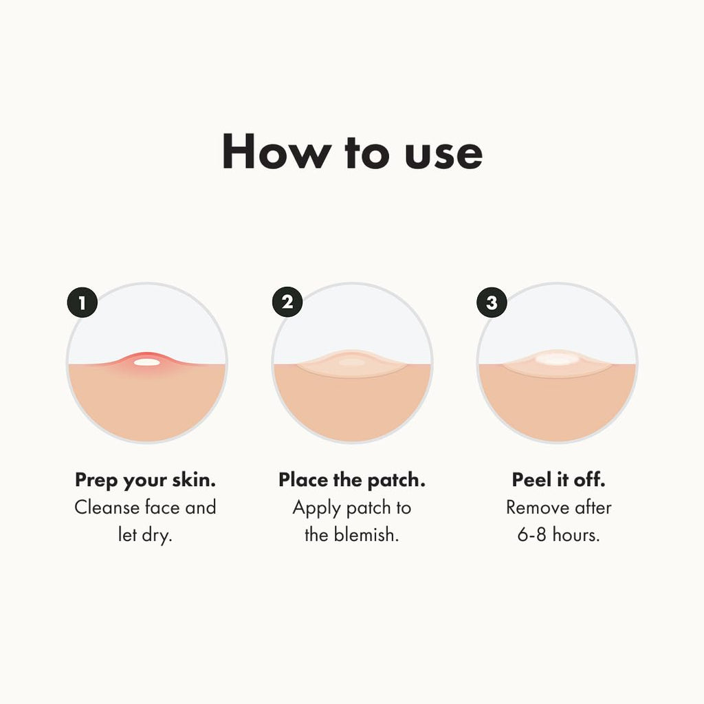 Mighty Patch Hero Cosmetics Original Nighttime Acne Pimple Patches, 36 Ct | #1 Hydrocolloid Acne Patches, Shrinking Zits & Whiteheads in 1 Use, Spot Treatment, Pimple Stickers for Face