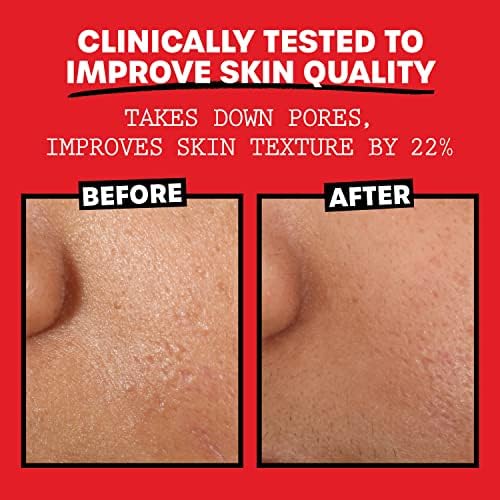 THAYERS Alcohol-Free, Hydrating, Unscented Witch Hazel Facial Toner with Aloe Vera Formula, Vegan, Dermatologist Tested and Recommended, 12 Oz (Packaging May Vary)