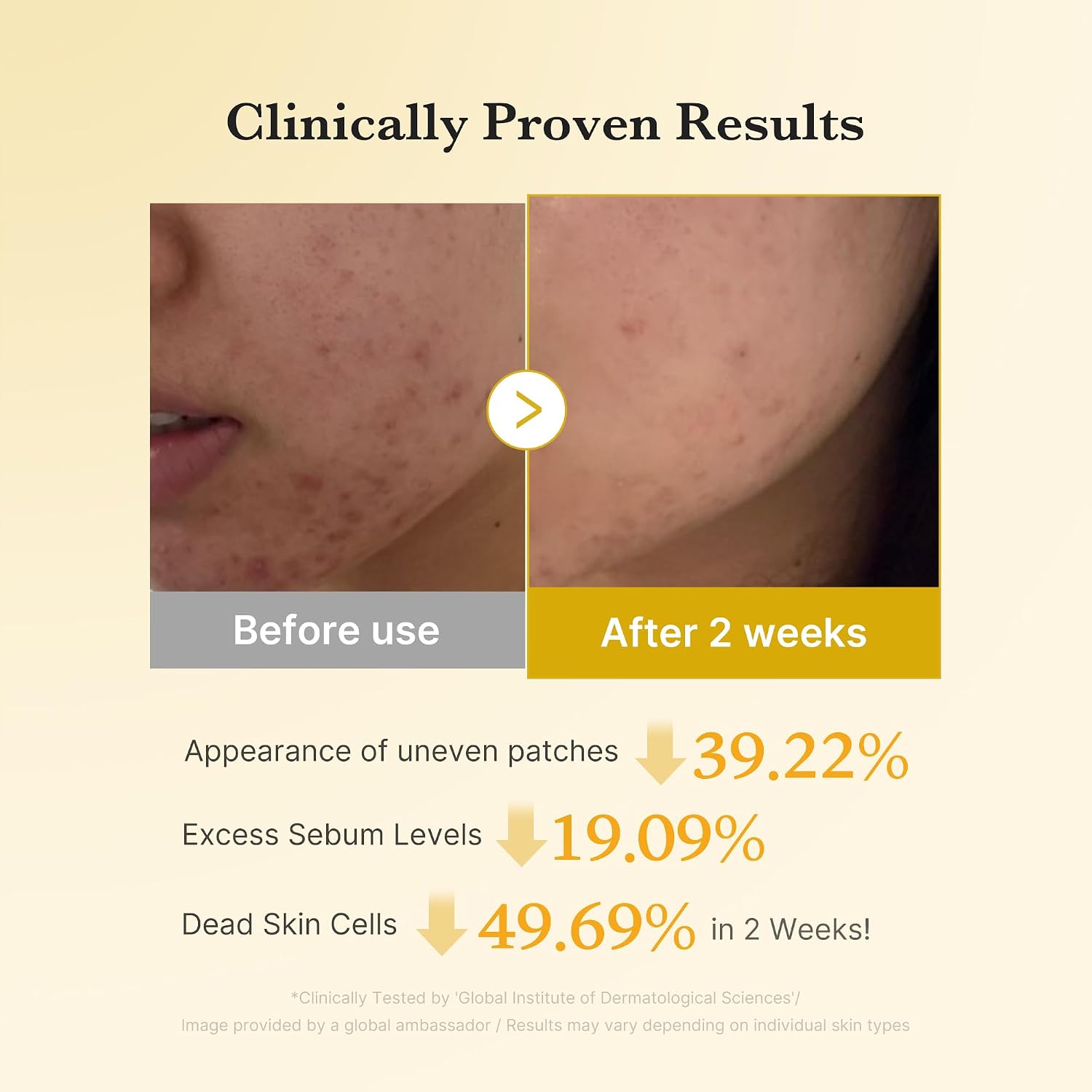 medicube Kojic Acid Renew & Smooth Duo for Troubled Skin: Kojic Acid Turmeric Clarifying Toner Pad and Kojic Acid Turmeric Clarifying & Balancing Capsule Serum