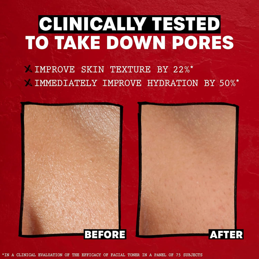 THAYERS Alcohol-Free, Hydrating, Unscented Witch Hazel Facial Toner with Aloe Vera Formula, Vegan, Dermatologist Tested and Recommended, 12 Oz (Packaging May Vary)