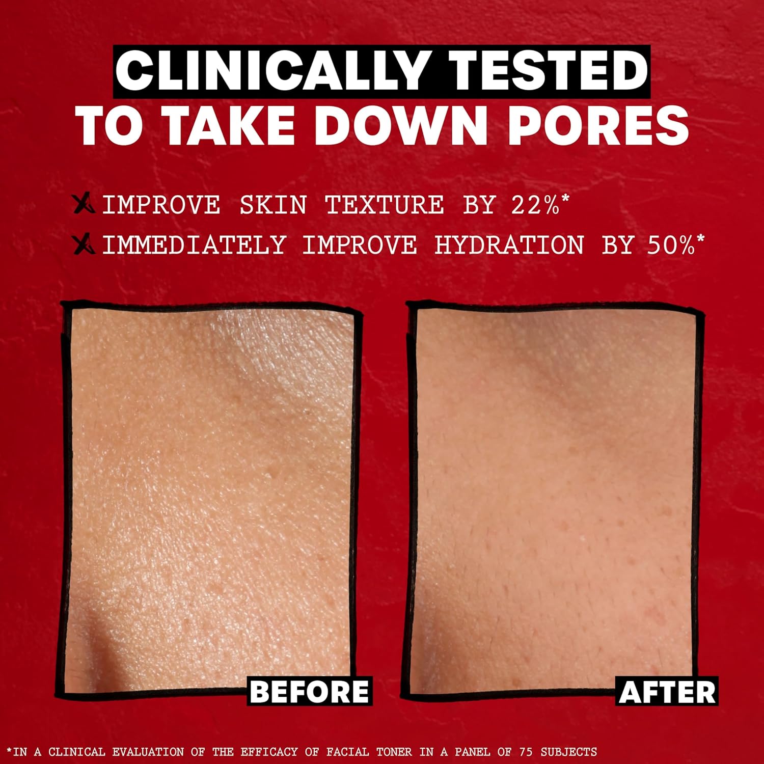 THAYERS Alcohol-Free, Hydrating, Unscented Witch Hazel Facial Toner with Aloe Vera Formula, Vegan, Dermatologist Tested and Recommended, 12 Oz (Packaging May Vary)
